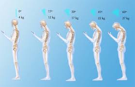 esqueletos que muestran en aumento del peso que reciben las vértebras según la posición de la cabeza