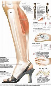 visión de una pierna y sus afectaciones al llevar tacones