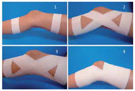 imágenes de la colocación en 4 pasos de un vendaje funcional para estabilización de rodilla