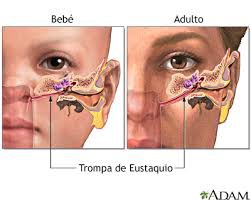 diferencia trompa de aurstaquio entre bebes y adultos