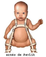imagen frontal de un bebé el cual lleva colocado el arnés de Pavlik para displasia de cadera