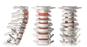 anatomía de los discos vertebrales del cuello