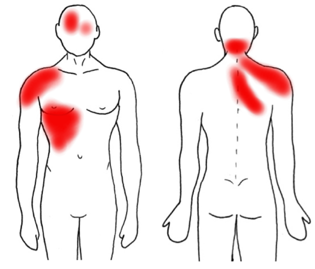 persona con las zonas de dolor del higado