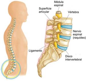 Protusión discal: Síntomas y tratamiento