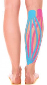 imagen de una pierna a nivel posterior con dos vendajes de kinesiotape con técnica de "pulpo"