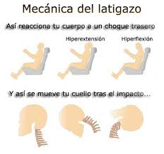 como afecta un accidente de trafico a la columna cervical
