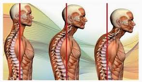 visión lateral de como afecta la posición de la cabeza a la postura