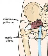 nervio ciático y su relación con el piramidal