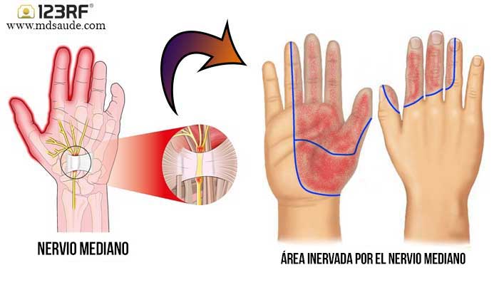 anatomía del carpo mostrando atrapamiento del túnel del carpio y su inervacion