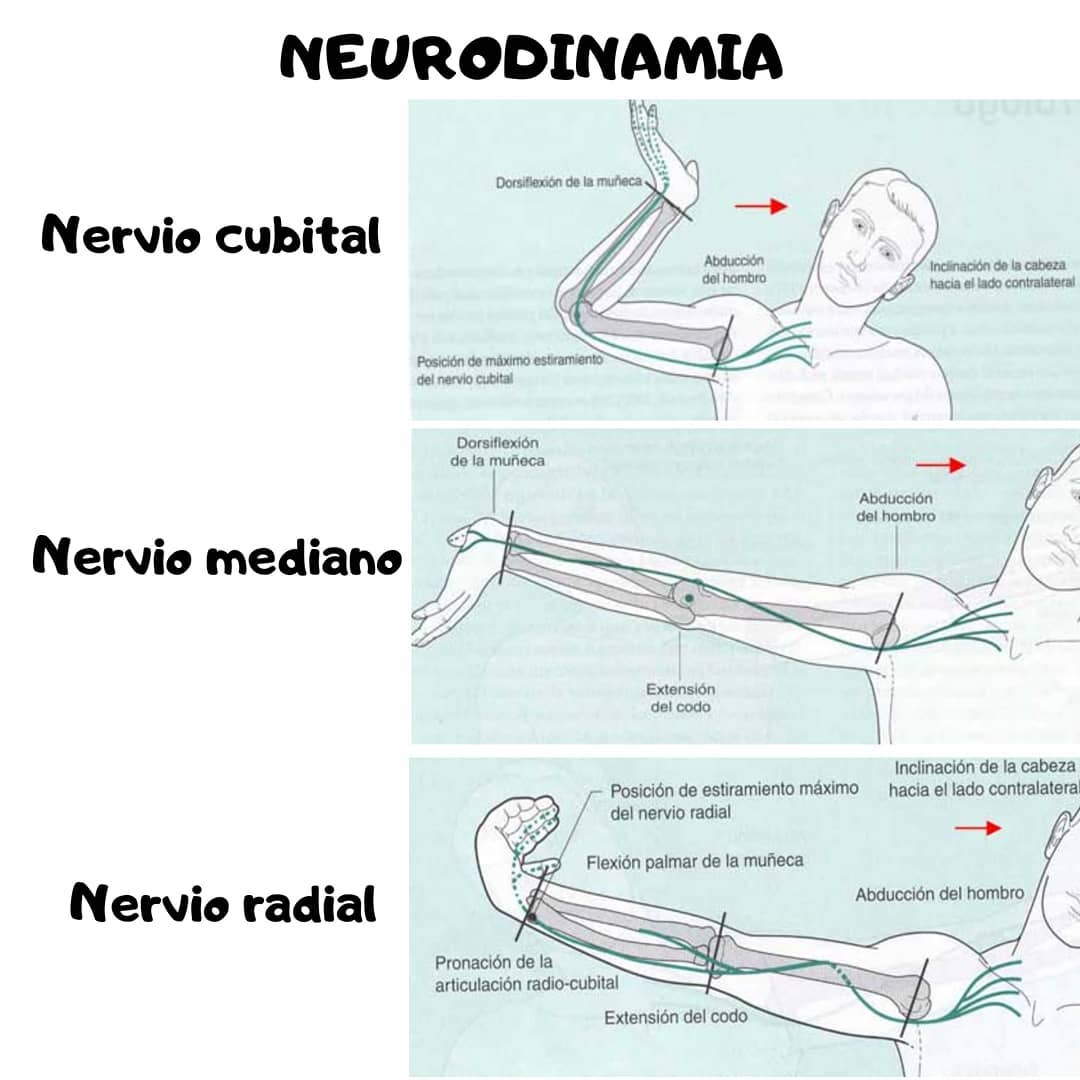 estiramientos neurodinámicos del brazo