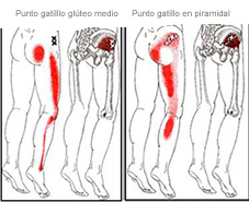 puntos gatillo de gluteo medio y piramidal y sus dolores referidos