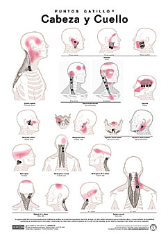 puntos-gatillo-cabeza-y-cuello